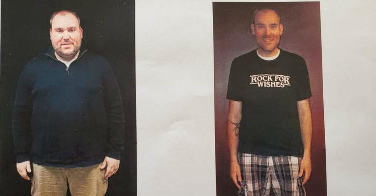 Brad Christenson before and after weight-loss surgery