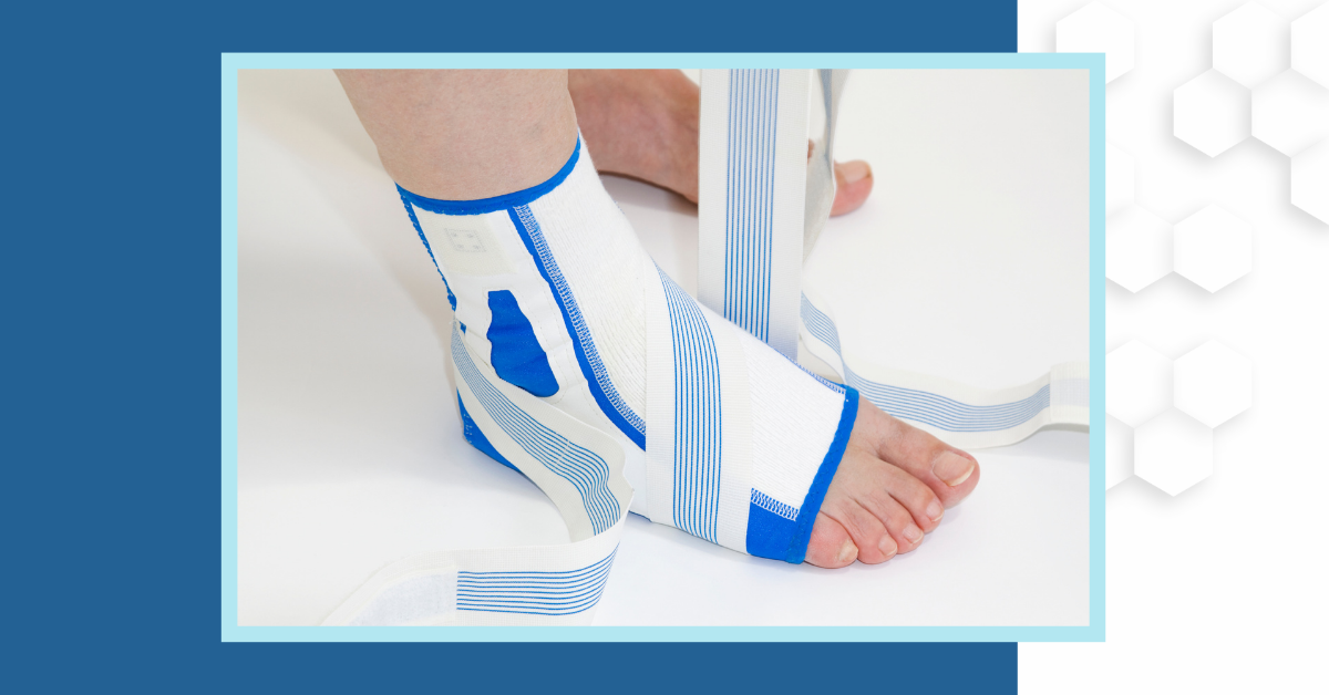 A person wears an ankle brace to treat an ankle sprain.