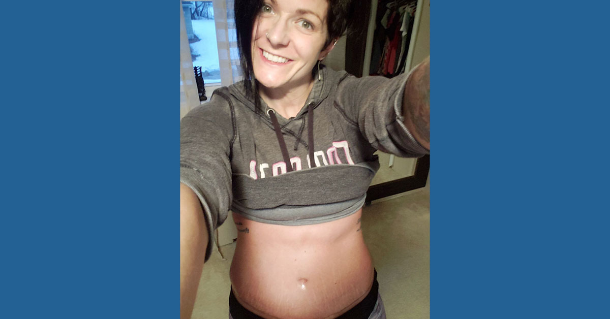 Jessica’s story: ‘I feel good in my own skin’ after tummy tuck